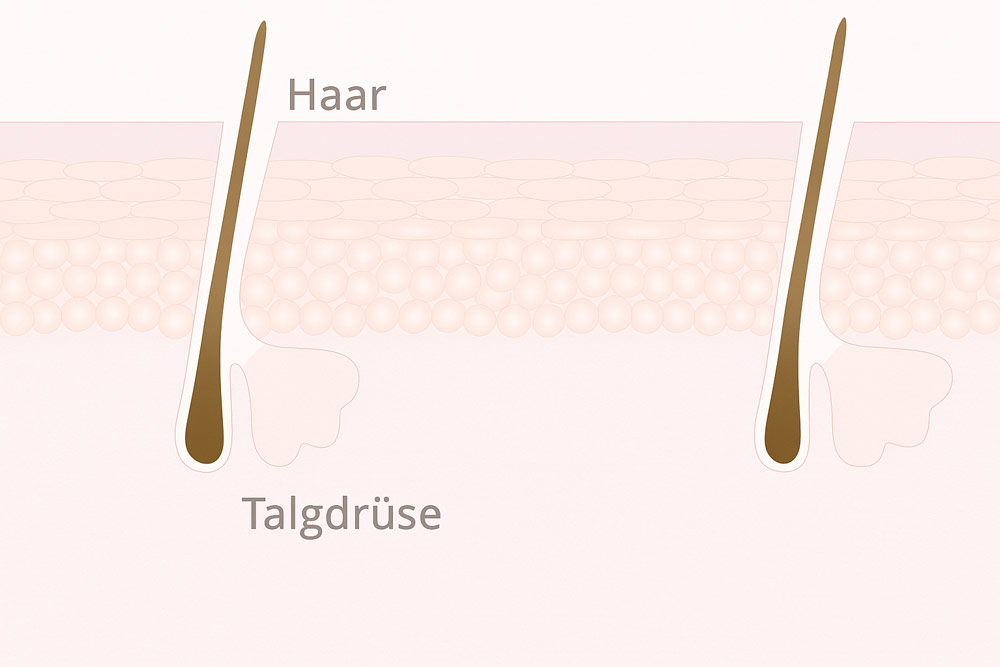 Talgfden auf der Nase: Unterschied zu Mitessern und was hilft | Dr. Jetske  Ultee - Dr. Jetske Ultee